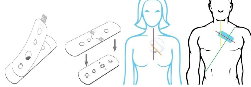 病患体征看护系统解决方案（物联网智慧医院）